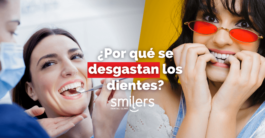 porque se desgastan los dientes smilers dental clinic dentistas mexico mexicali algodones