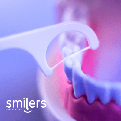 usos del hilo dental