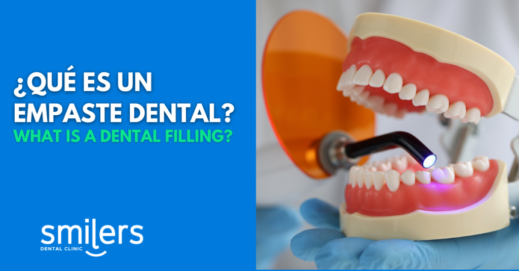 What is a Dental Filling? What Does Dental Filling Entail?
