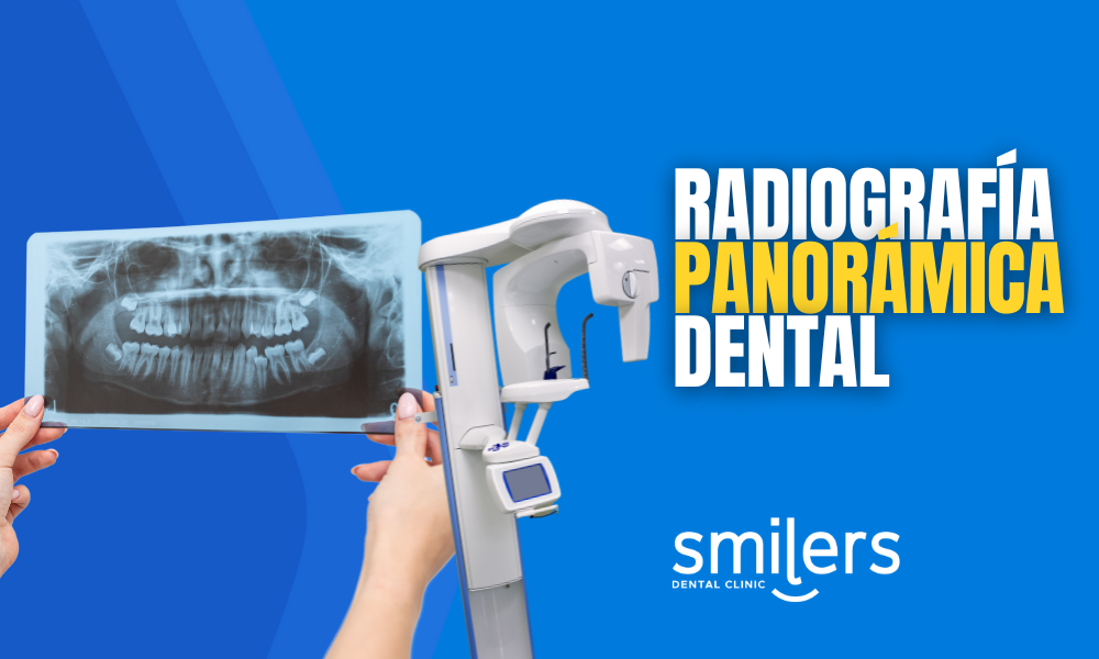 radiografia panoramica dental todo lo que tienes que saber
