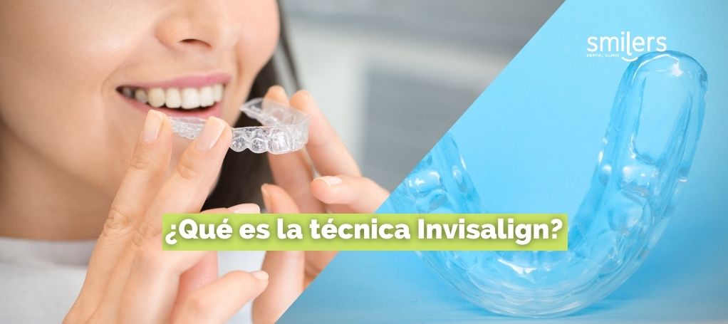 Que es la tecnica invisalign dentistas mexicali los algodones tijuana mexico tratamiento dental