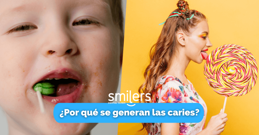 por que se generan las caries dentistas mexicali dentistas mexicali tijuana los algodones dentista