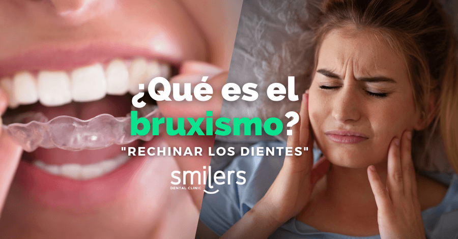 que es el bruxismo dentistas mexico tratamientos dentales mexicali tijuana algodones