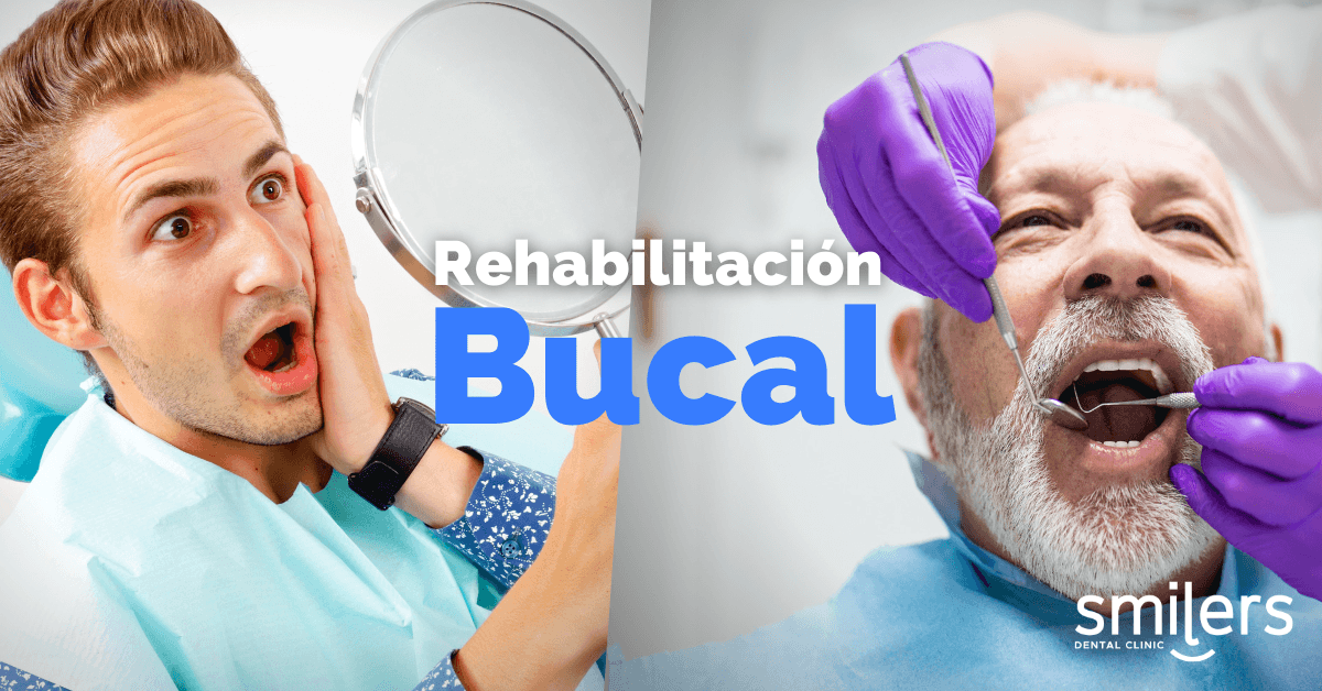 ¿Qué Es La Rehabilitación Dental? Pasos A Seguir Para Recuperar Tu Sonrisa