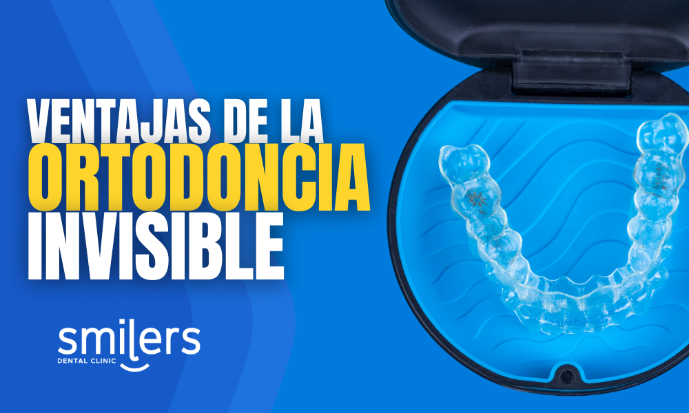 5 ventajas de la ortodoncia invisible